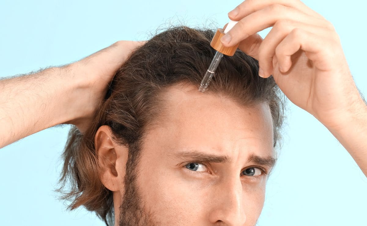 caida de pelo caida de pelo